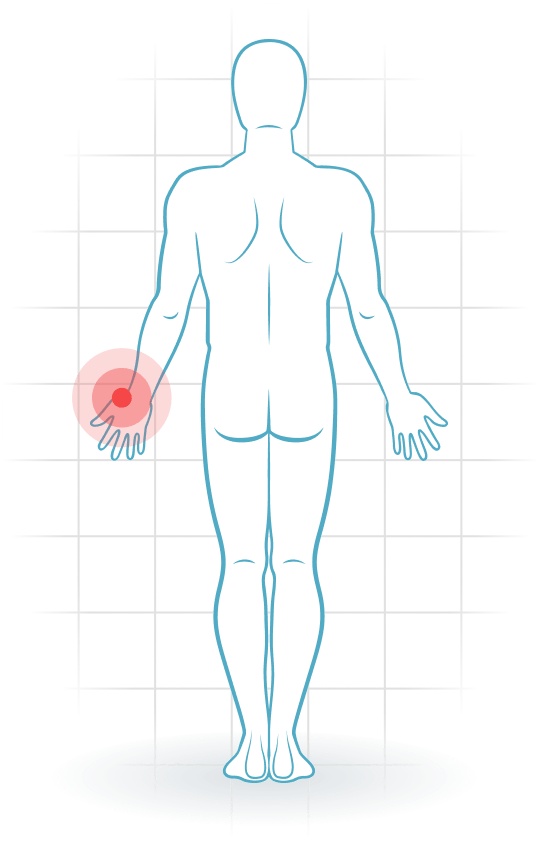 pijnlocatie Base of thumb arthritis